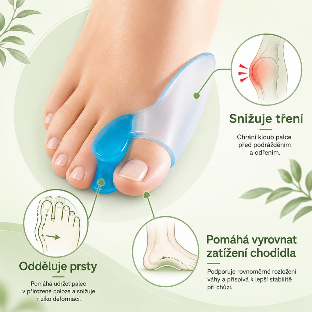 Použití gelového chrániče palce v botě při hallux valgus